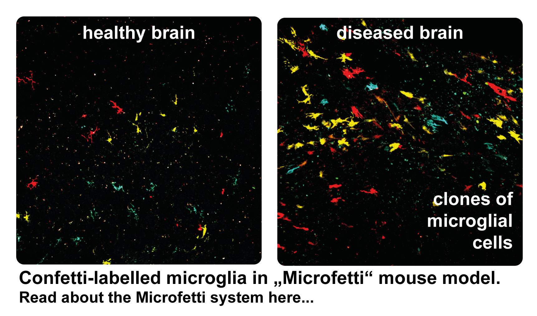 Confetti-labelled
            microglia